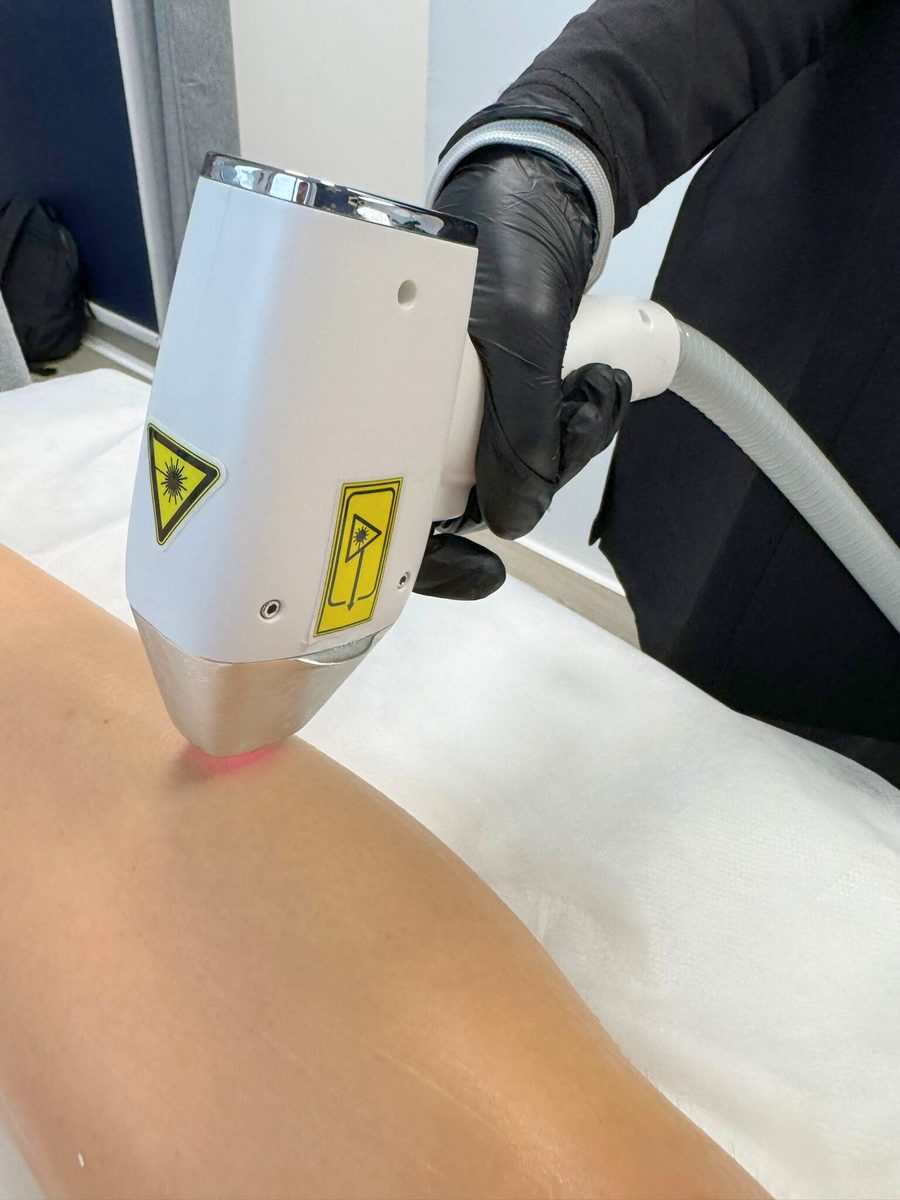 Séance de formation à l'épilation laser