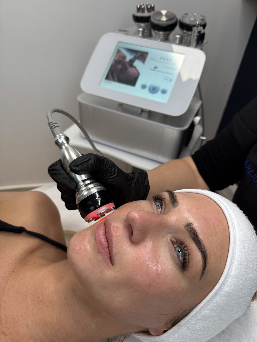 Soin du visage par radiofréquence